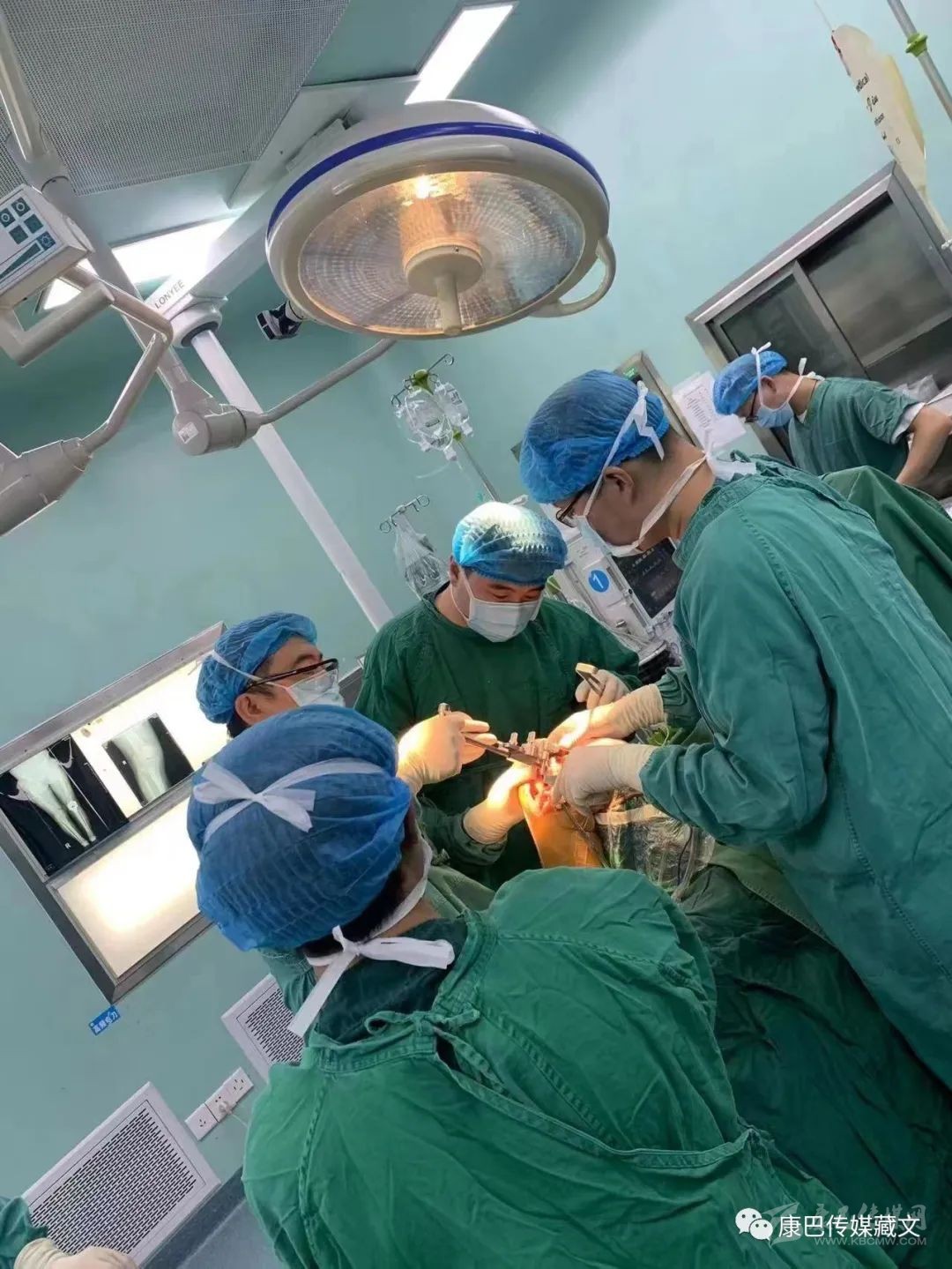 ད་ལྟ་དཔྱི་ཚིགས་དང་པུས་ཚིགས་བརྗེས་ན་སྒོར་མོ་སྟོང་འགའ་ལས་མི་དགོས།